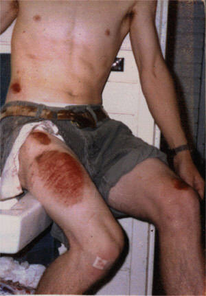 Yikes!  Thatll leave a mark.